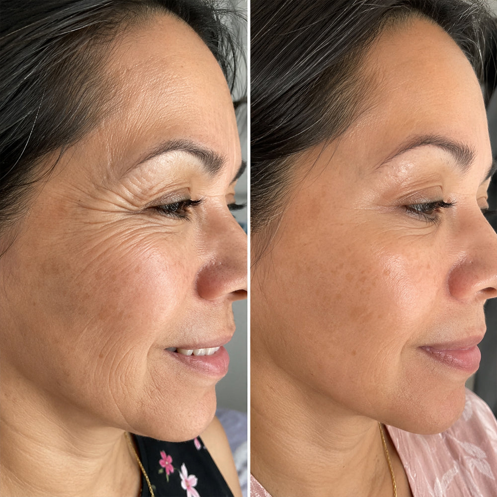 Karen's foundation result